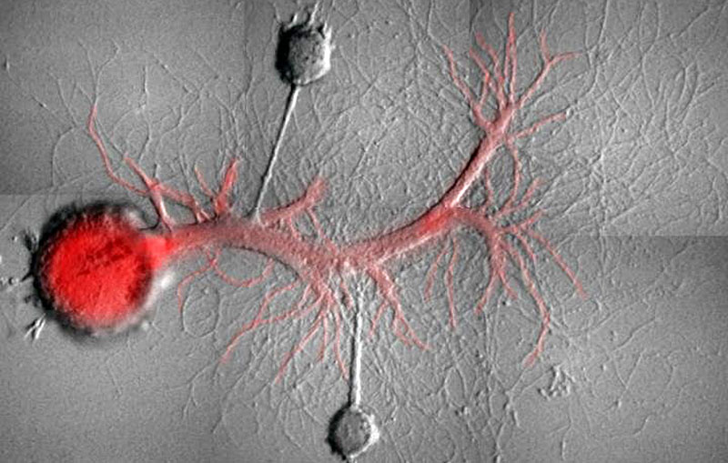Las neuronas del caracol usadas para los experimentos. Foto: Universidad de Columbia